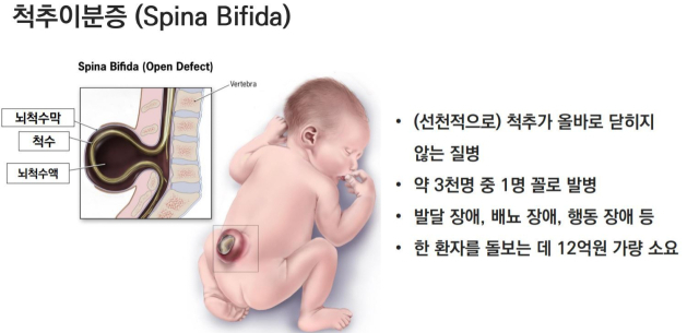 출처: 연세대 김상우 교수 브리핑 자료