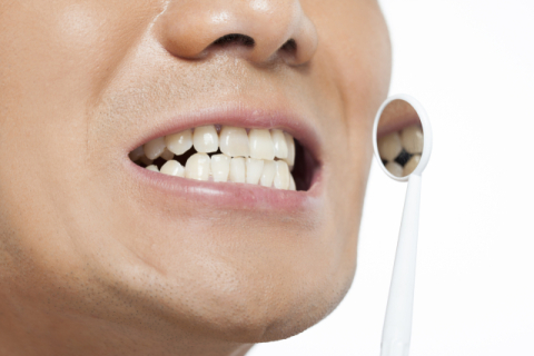 연말까지 스케일링 진료 받으세요