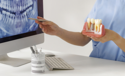 ‘수면·무통치료 임플란트’ 표현에 속지 마세요